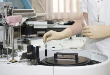 Wie lange ist Alkohol im Blut nachweisbar?