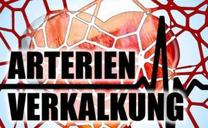 Arterienverkalkung – Arteriosklerose