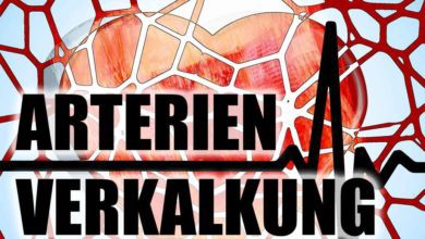 Arterienverkalkung - vorbeugen und behandeln der Arteriosklerose
