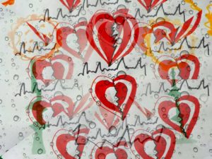 Bluthochdruck Symptom Herzrasen