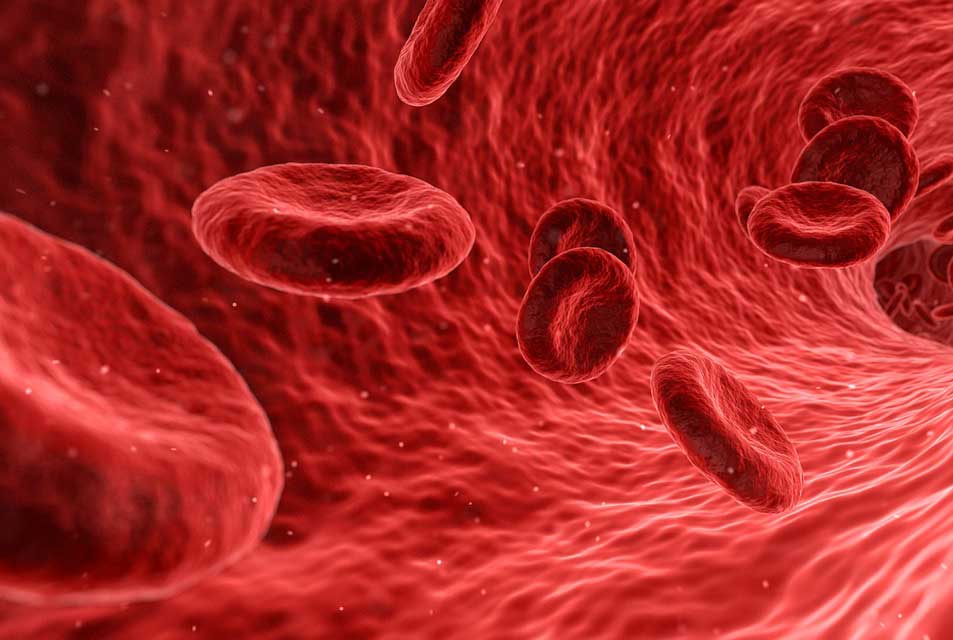 Bluthochdruck Ursache Cholesterin