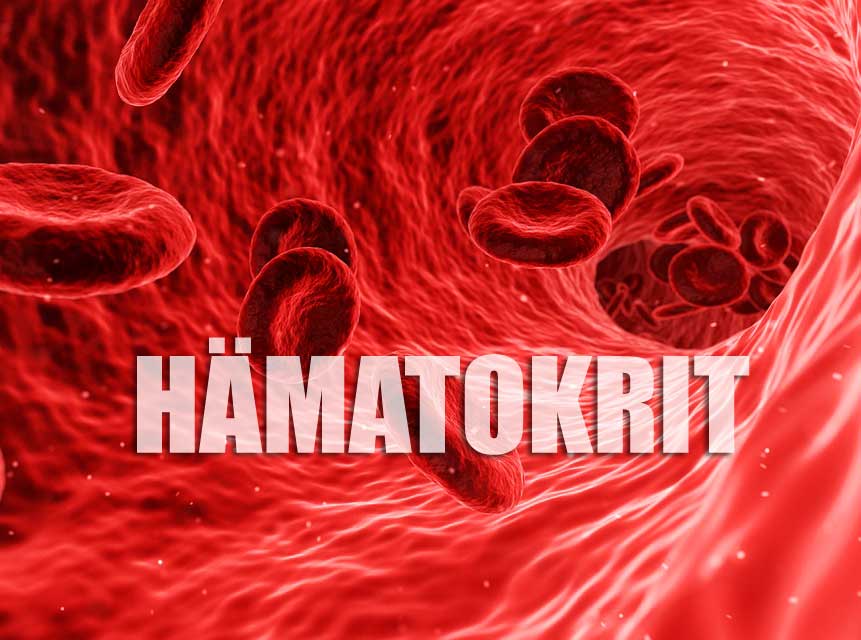 Hämatokrit – niedrig oder erhöht – Ursachen und Symptome